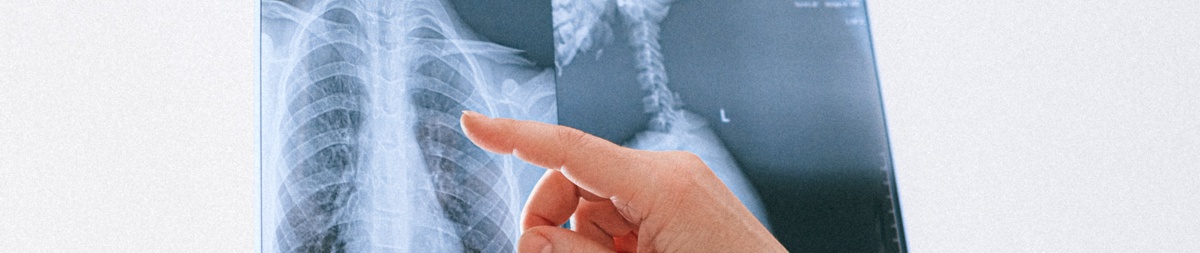 L’ambulatorio di Pneumotisiologia territoriale di Chieti centro resterà chiuso lunedì 31 ottobre 2022