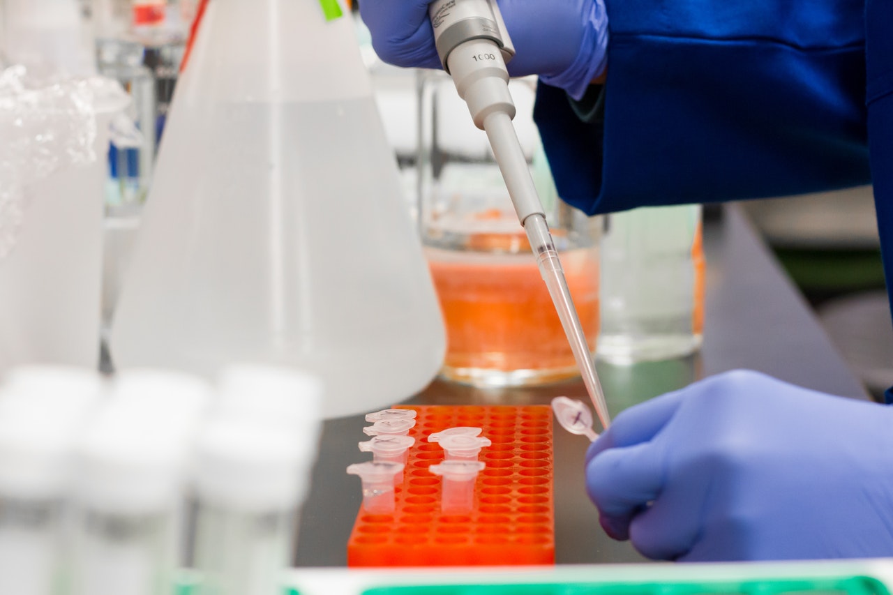 Covid-19, Schael: “Per i test utilizziamo l’Università d’Annunzio”