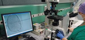 Attività nel Centro di procreazione medicalmente assistita dell'ospedale di Ortona